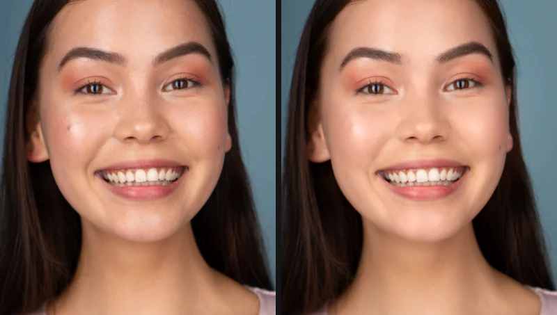 Cận mặt một cô gái đang cười trước và sau khi retouch bằng Fotoreto: xoá mụn, làm mịn da, đều màu da, trắng răng