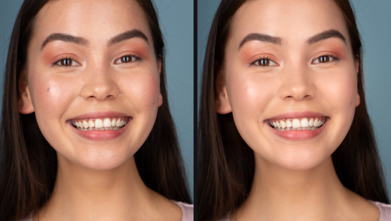 Cận mặt một cô gái đang cười trước và sau khi retouch bằng Fotoreto: xoá mụn, làm mịn da, đều màu da, trắng răng