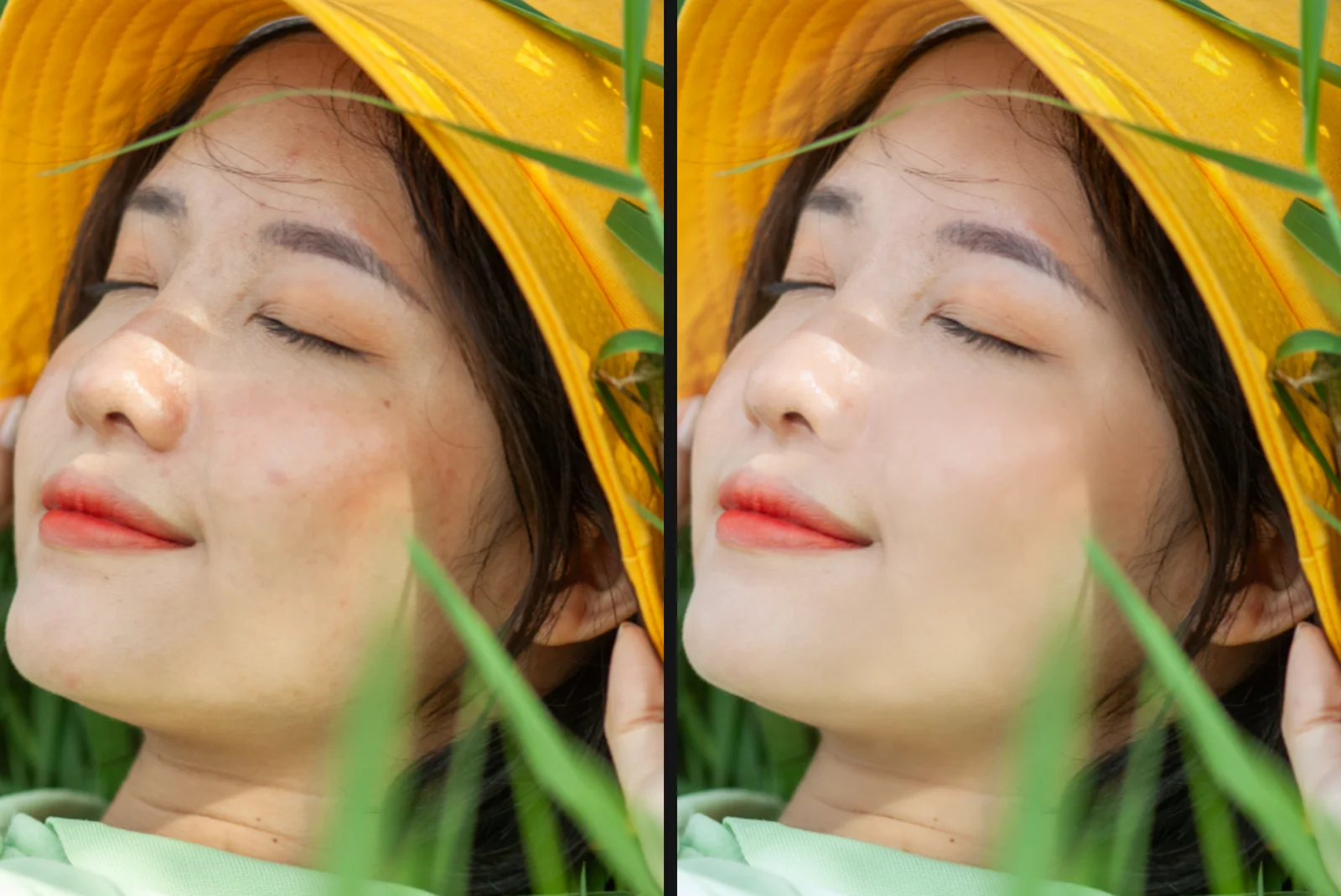 Cận mặt trước và sau khi retouch: bên trái ảnh gốc có mụn đỏ và tàn nhang, bên phải sau khi xoá mụn, làm mịn da và đều màu da