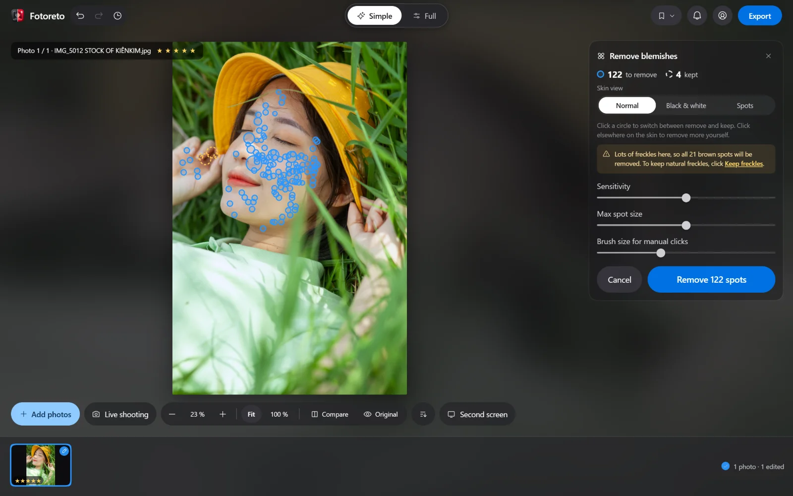 The Remove blemishes card in Fotoreto: blue circles mark 122 spots found on the face, a note about freckles and a Keep freckles link